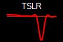 TSLR
